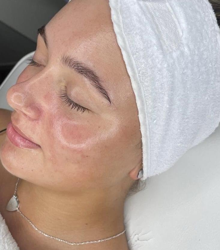 Client receiving a facial treatment at Rollo House in Longniddry